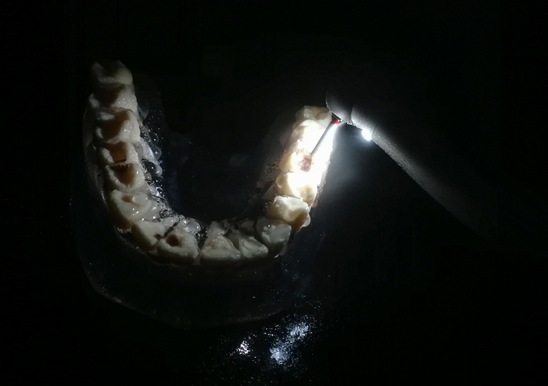 Solving Dental Handpiece Water and Air Troubles in Dental Chair