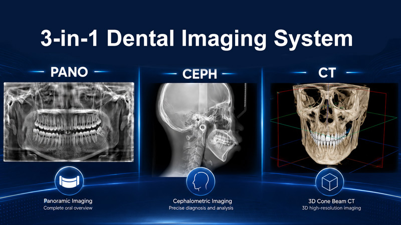 https://www.lingchendental.com/ai-powered-dental-cone-beam-computed-tomography-cbct-scanner-with-pano-ceph-3d-ct-imaging-product/