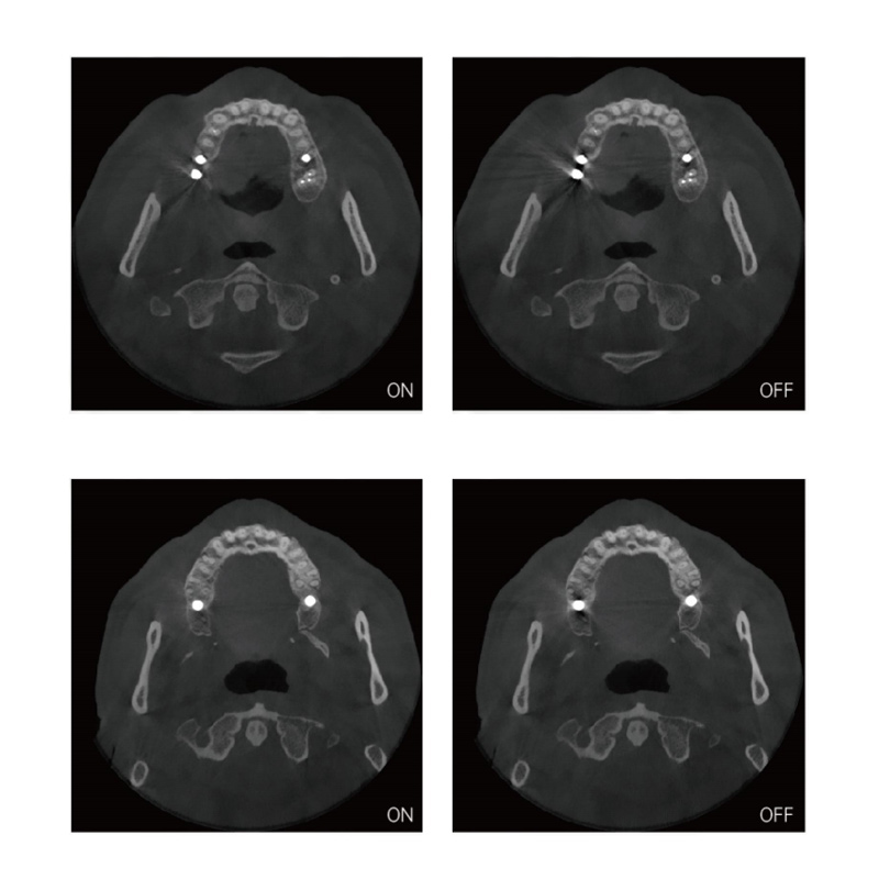 https://www.lingchendental.com/ai-powered-dental-cone-beam-computed-tomography-cbct-scanner-with-pano-ceph-3d-ct-imaging-product/