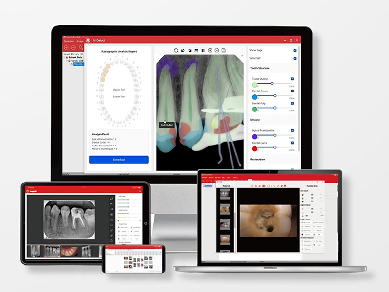 https://www.lingchendental.com/high-resolution-cmos-digital-dental-x-ray-sensor-product/
