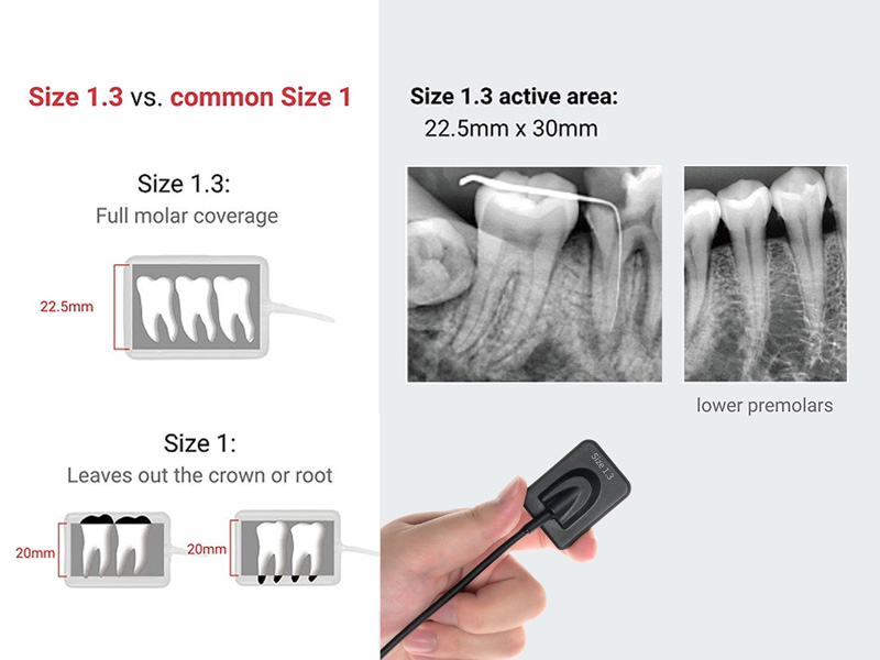 https://www.lingchendental.com/high-resolution-cmos-digital-dental-x-ray-sensor-product/
