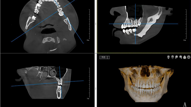 https://www.lingchendental.com/ai-powered-dental-cone-beam-computed-tomography-cbct-scanner-with-pano-ceph-3d-ct-imaging-product/