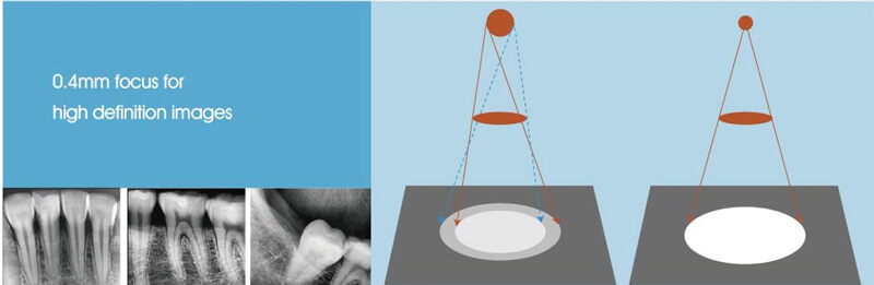 handheld dental x ray machine