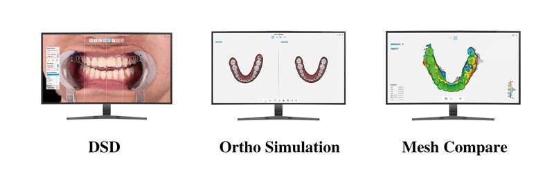 intraoral dental scanner