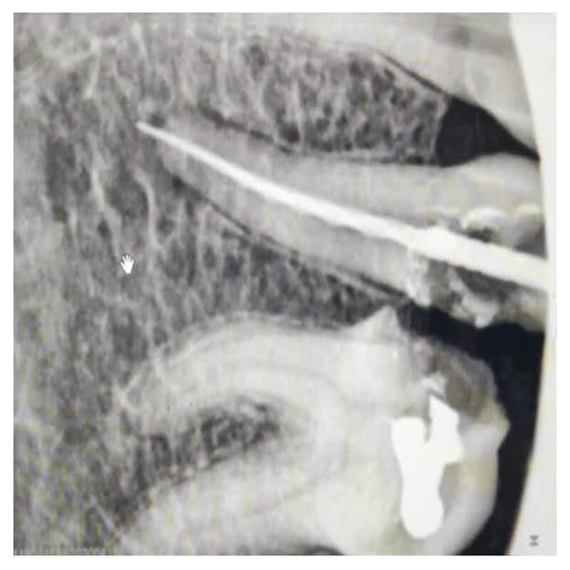 portable dental x ray unit